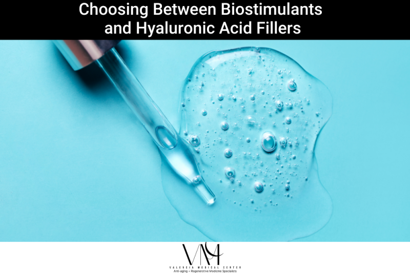 Choosing Between Biostimulants and Hyaluronic Acid Fillers