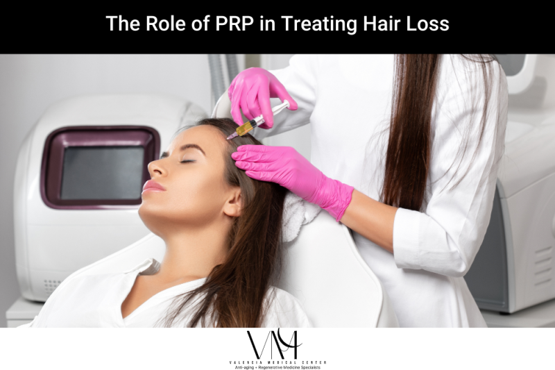 The Role of PRP in Treating Hair Loss