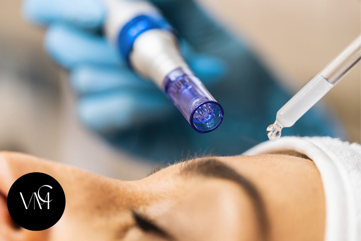 PRP Microneedling for Acne Scars: Before, After & What to Expect