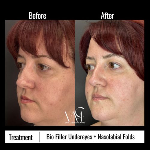 Neutral-Before-and-After-Instagram-Post---13